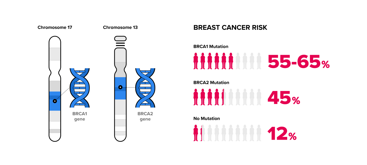 BRCA1/2 유전자 검사