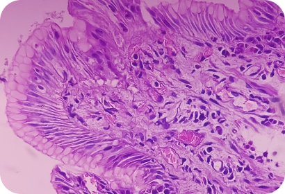 Spatial Transcriptome Analysis 공간전사체 분석 서비스